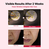 Yam Mucin ABCE Boosting Bundle
