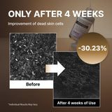 Sérum exfoliant NIDA White Black (duo) 