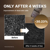 Suero exfoliante para puntos negros con arroz negro NIDA