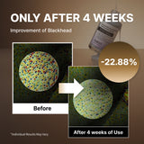 Sérum exfoliant NIDA White Black (duo) 