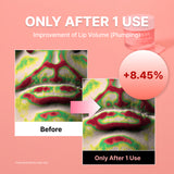 Set de cuidado labial definitivo de NIDA (suero labial + mascarilla labial)