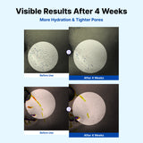 Crema humectante definitiva NIDA Youthful Formula™ 