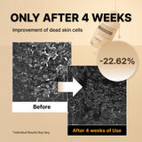 Sérum exfoliant NIDA White Black (duo) 