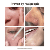 Suero exfoliante para puntos negros con arroz negro NIDA