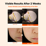 NIDA Ultimate Dark Spot Brightening Bundle (Global)